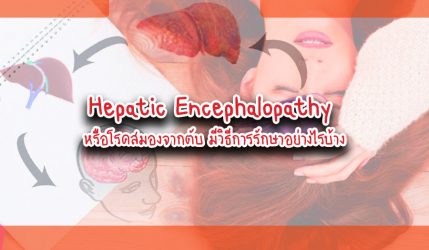 Hepatic Encephalopathy หรือโรคสมองจากตับมีมีวิธีการรักษาอย่างไรบ้าง